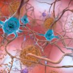 Bufeurile, un indicator timpuriu pentru Alzheimer? – studiu