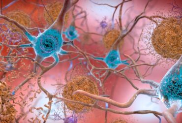 Bufeurile, un indicator timpuriu pentru Alzheimer? – studiu